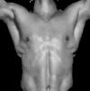 man body reconstruction