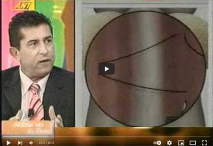 πλαστικής κοιλιάς